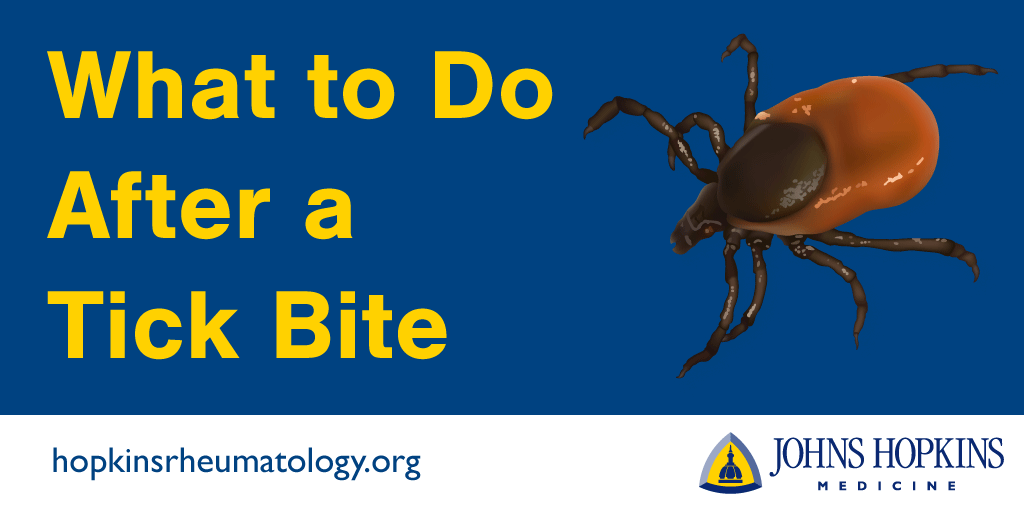 What To Do After A Tick Bite Lyme Disease Johns Hopkins