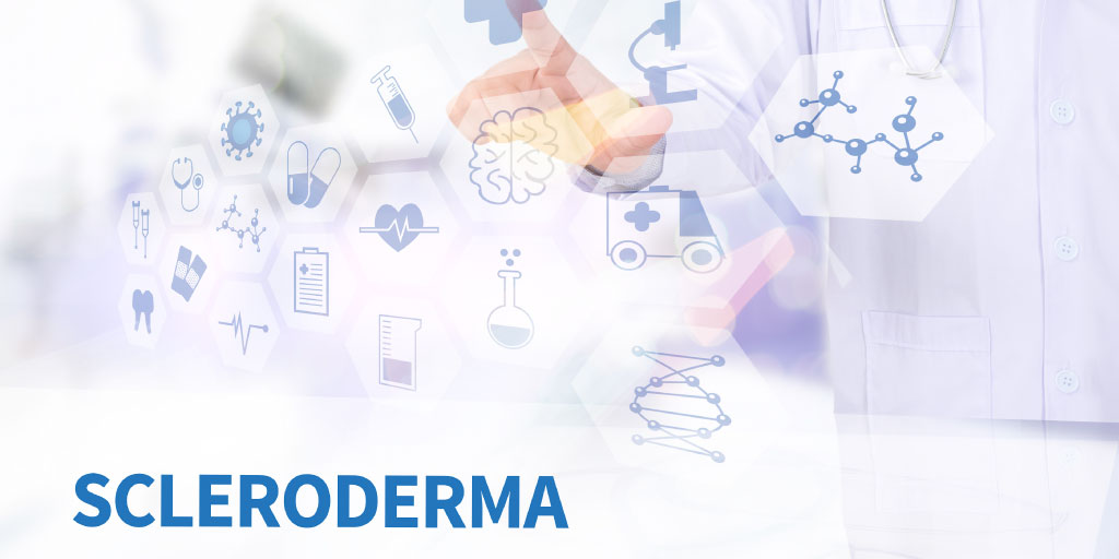 Scleroderma