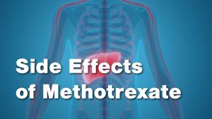 Side Effects of Methotrexate