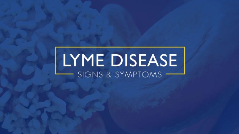 Lyme Disease Signs and Symptoms • Johns Hopkins Rheumatology