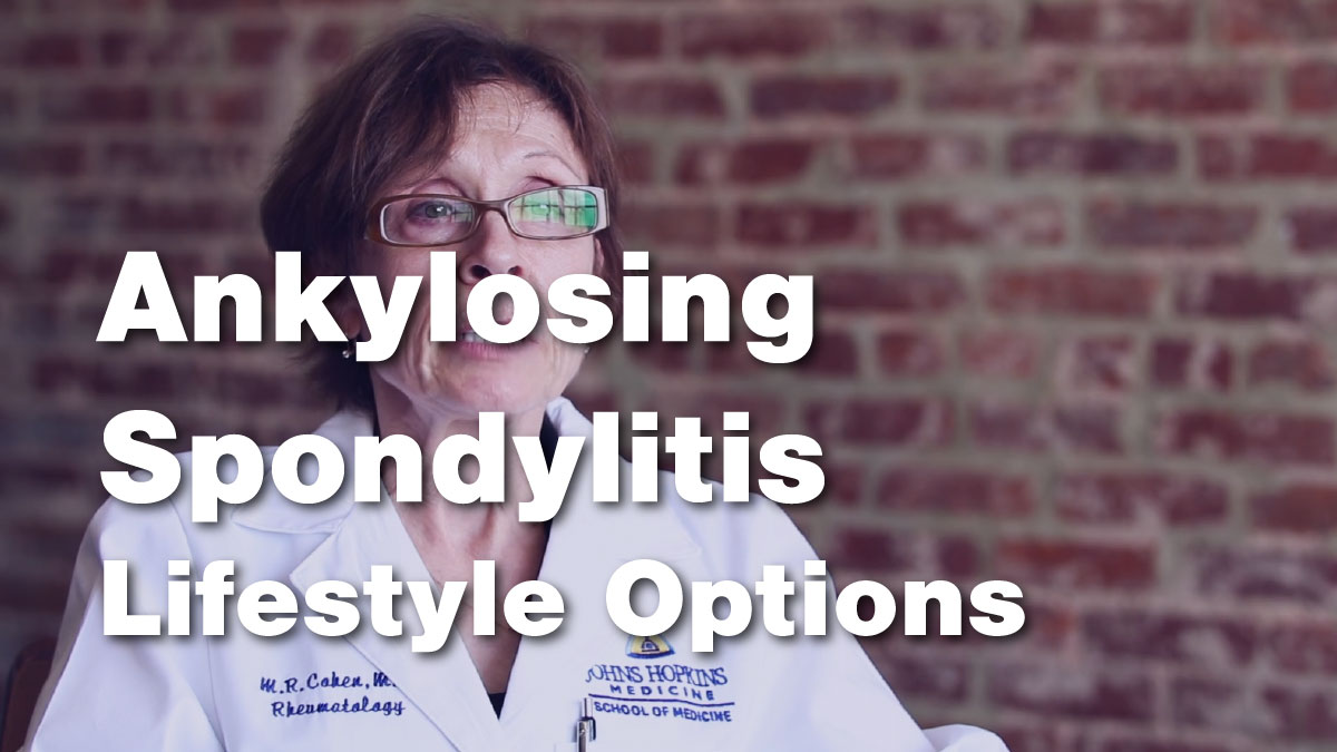 Ankylosing Spondylitis – Lifestyle Options