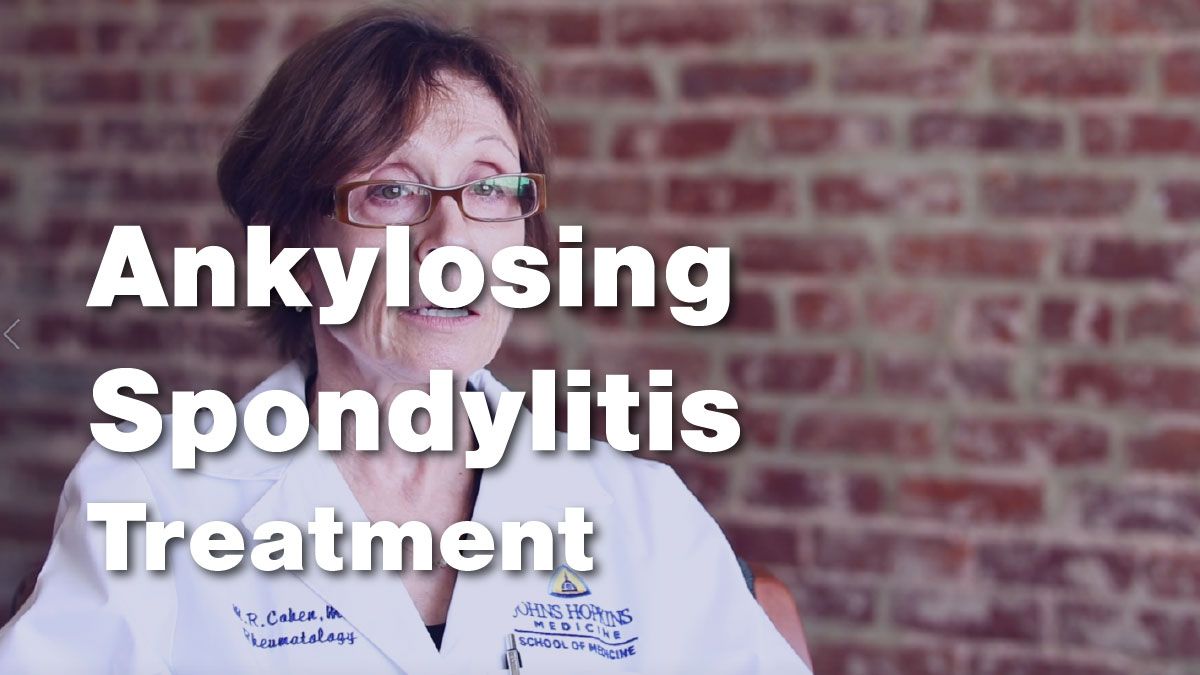 Ankylosing Spondylitis – Treatment