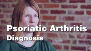 Dr. Orbai discusses diagnosing Psoriatic Arthritis