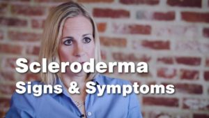 Signs and Symptoms of Scleroderma