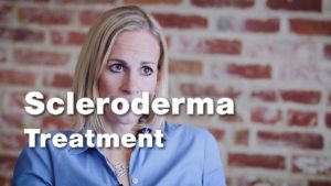 Treatment of Scleroderma