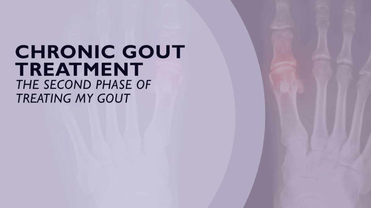 Chronic Gout Treatment – The Second Phase of Treating Gout
