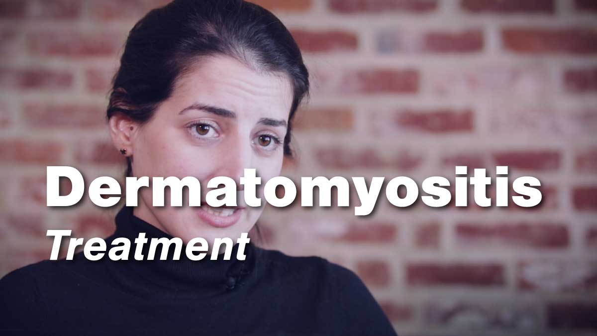 Dermatomyositis – Treatment | Johns Hopkins