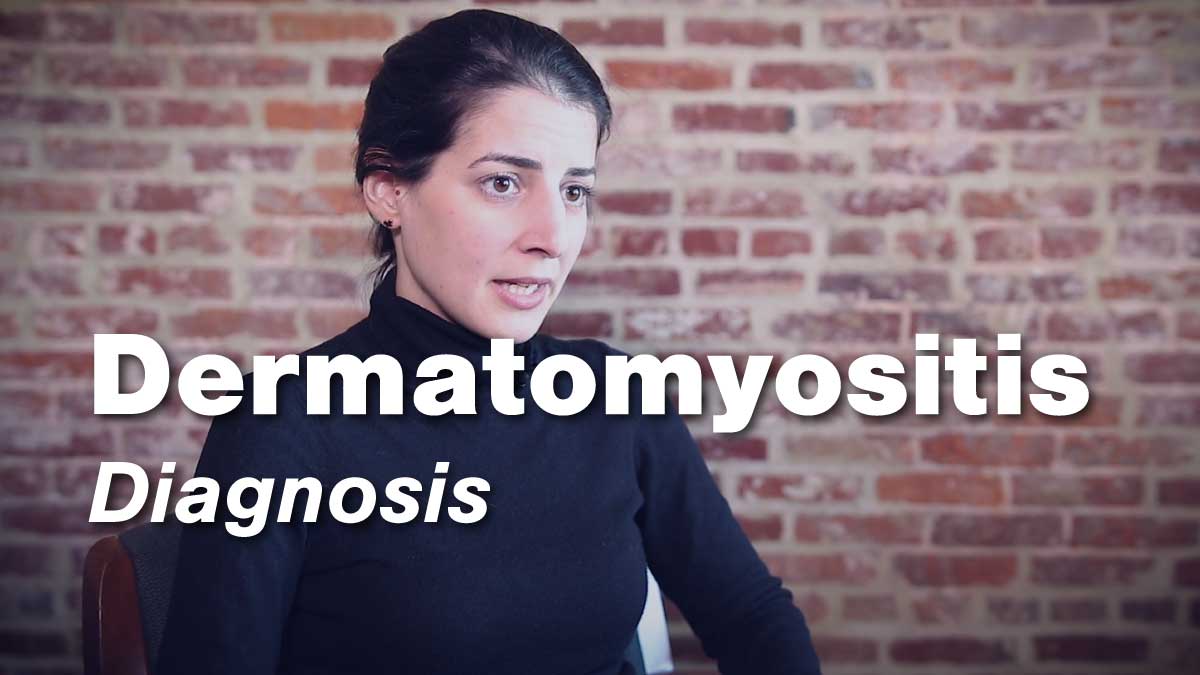 Dermatomyositis – Diagnosis | Johns Hopkins