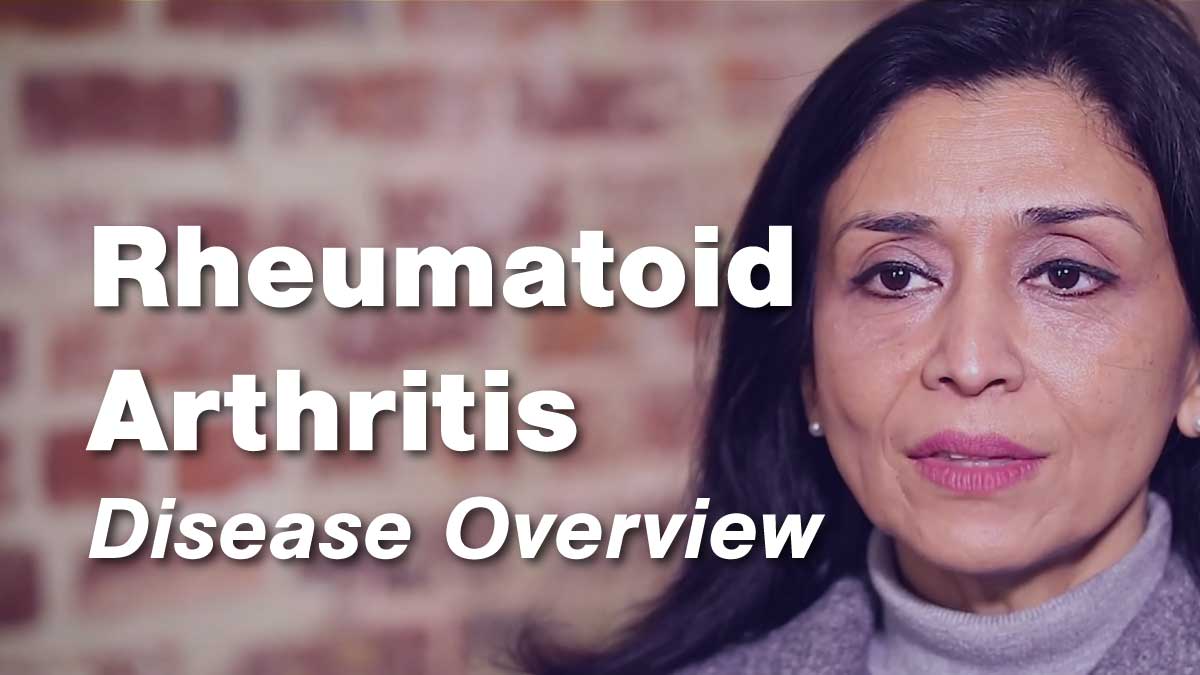 Rheumatoid Arthritis – Disease Overview | Johns Hopkins