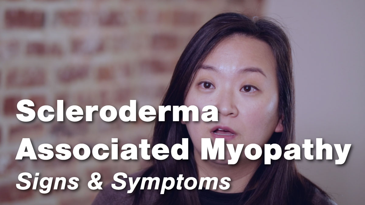 Scleroderma Associated Myopathy – Signs & Symptoms