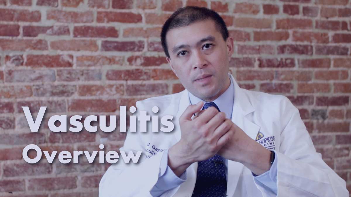 Vasculitis – Overview | Johns Hopkins Rheumatology