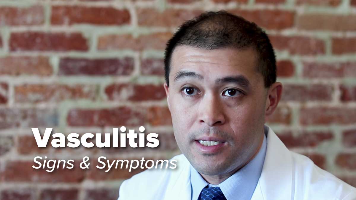 Vasculitis – Signs & Symptoms | Johns Hopkins Rheumatology