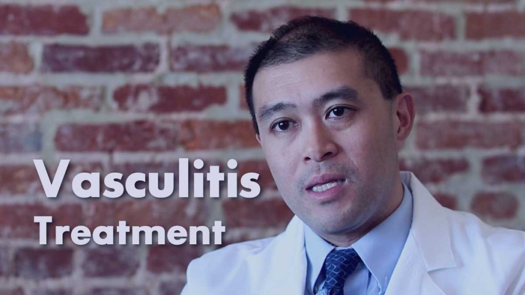 Vasculitistreatment • Johns Hopkins Rheumatology